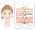 Mechanism of skin cell turnover illustration. Melanin and melanocytes in human skin layer with woman face. beauty and skin care