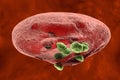 Release of malaria parasites from red blood cell Royalty Free Stock Photo