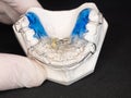 Removable Brace or Retainer for Teeth correction