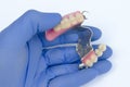 Removable clasp prosthesis in the dentistÃ¢â¬â¢s hand