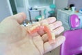 Removable denture in the hands of a doctor Royalty Free Stock Photo