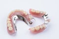 Removable metal partial denture on white background