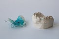 A removable orthodontic appliance and plaster cast from patient jaw. Concept of pediatric dentistry, correcting the bite