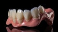 Removable partial denture medically accurate tooth. Royalty Free Stock Photo