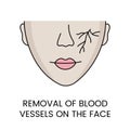 Removal of blood vessels on the face with the help of laser cosmetology, in vector woman's face with a vascular