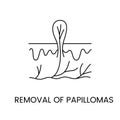 Removal of papillomas line icon in vector, illustration of papilloma in skin layers