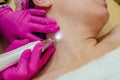 Removal of papillomas on neck in a beauty salon