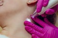 Removal of papillomas on neck in a beauty salon