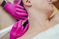 Removal of papillomas on neck in a beauty salon