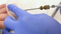 Removal of papillomas and warts on the hand with liquid nitrogen in a special device with a probe - cryodestructors.