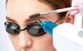 Removal of permanent makeup on the eyebrows of a woman.Carbon face peeling in a beauty salon. Hardware cosmetology treatment Royalty Free Stock Photo