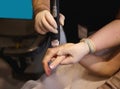 Close-up of professional removal of pigment spots and hair from the hands using a medical laser in a spa clinic