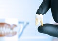 Removal of a tooth. Dentist doctor shows tooth structure. Dental layout. Dental implant. The doctor holds a tooth in black gloves Royalty Free Stock Photo
