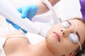 Removing acne scars by laser.