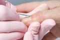 Removing cuticle from the nail