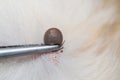 Removing tick with metalic tweezers