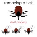 Removing a tick