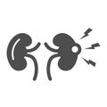 Renal pain solid icon, Body pain concept, Kidney pain sign on white background, renal colic icon in glyph style for