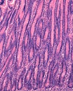 Renewal of intestinal epithelium. Mitosis