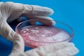 Research of viruses and bacteria, researcher holds a Petri dish with a sample.