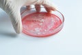 Research of viruses and bacteria, researcher holds a Petri dish with a sample.