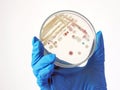 Researcher is holding Petri dish of Vibrio vulnificus in CHROMagar and TCBS, an estuarine bacterium which occurs in in filter-feed