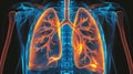 Respiratory infections illustration pneumonia, bronchitis, and tuberculosis affecting the lungs.