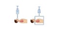 Respiratory system of human the anatomy of airways. Principle of artificial lung ventilation by positive and negative pressure