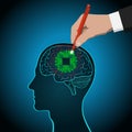 Restoration of brain functions, prosthetics of affected areas, mind, consciousness, memory, surgical treatment of brain