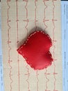 Result heart electrocardiogram and heart logo closeup