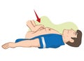 Resuscitation CPR, abdominal compression massage