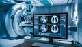 AI Technology in Advanced Diagnostic Imaging Facility