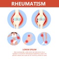 Rheumatism infographic. Bone disease on foot, hand Royalty Free Stock Photo