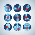 Rheumatism or rheumatic disorder medical set. Arthritis joint pain. Rheumatology vector infographics