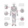 Joint pain vector body parts with pain ring