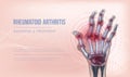 Rheumatoid arthritis banner hand joints deformation. Royalty Free Stock Photo