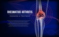 Rheumatoid arthritis Bones the of knee