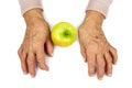 Rheumatoid arthritis hands and fruits Royalty Free Stock Photo