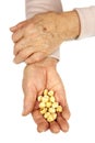 Rheumatoid arthritis hands Royalty Free Stock Photo