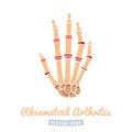 Rheumatoid arthritis icon