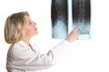 Rheumatologist showing lumbar vertebra