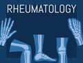 rheumatology bones poster