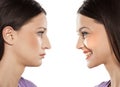 Rhinoplasty