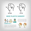 Rhinoplasty Nose Plastic Surgery logos Vector art line icons set