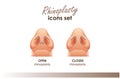 Rhinoplasty. Open and closed rhinoplasty. Bottom view. Plastic surgery nose. Medical and beauty illustration