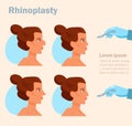 Rhinoplasty. Plastic surgery Vector.