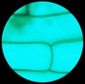 Rhode flagellate protozoa under a microscope (Allium Scale Eugle