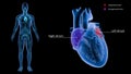 Right Atrium and Left Atrium of Heart