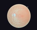 Right eye`s retinal image isolated on a black background