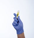 Right hand in blue glove holding a yellow medical thermometer